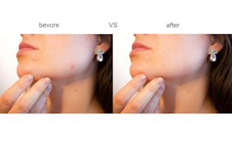retouch your photos and remove acne, redness and blemishes