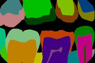 annotate dental x rays, fdi numbering and dental mri images