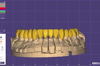 design crown and bridge using exocad