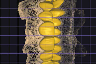 create accurate dental prosthesis designs using exocad