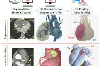 perform high quality ct mri dicom segmentation and create accurate 3d stl models