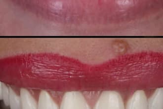 deliver professional exocad modeling for dental labs and clinics