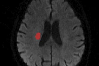 image segmentation, annotation, medical imaging