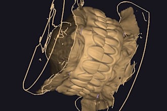 create accurate implant prosthesis designs using exocad