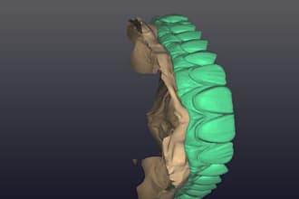 create accurate dental prosthesis designs using exocad