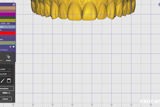 create accurate implant prosthesis designs using exocad