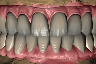 do highly ethetics dental restorations aox bridges on exocad