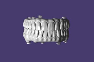 design dental restorations in exocad