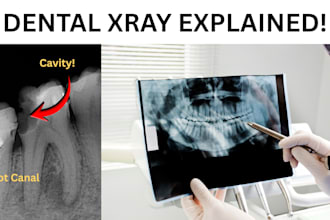 professionally read and explain your dental x rays