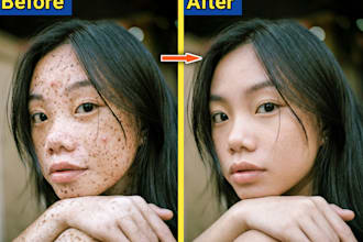 professional skin retouching, face retouch, blemish removal