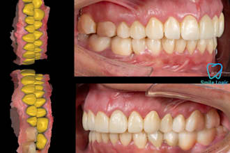 design professional crown and bridge for dentists and labs using exocad
