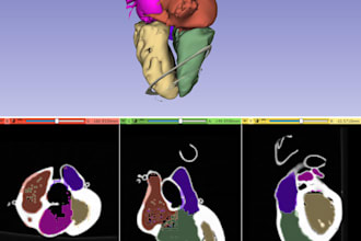 convert ct and mri scans into 3d printable medical models