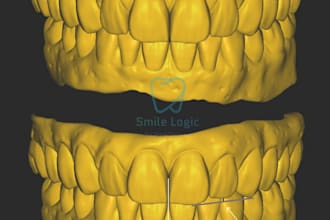 create accurate implant cad restorations in exocad
