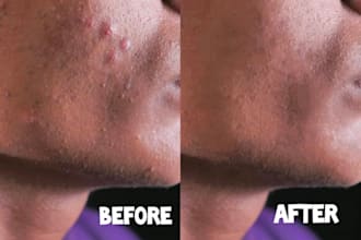 retouch face and remove acne, scars, and skin imperfections