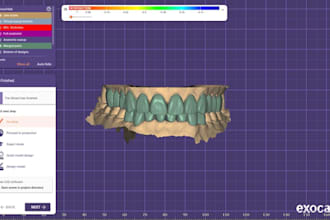 design professional dental cad designs in exocad
