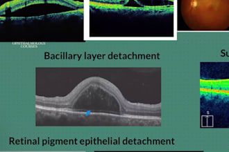 explain and simplify corneal topography,pentacam,and oct
