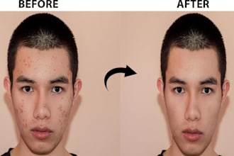 face skin retouching,remove dark circles,unwanted spots