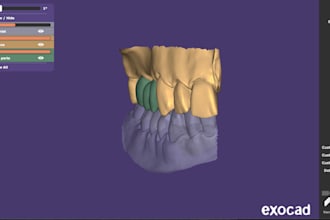 design dental crowns and bridges using exocad