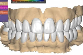 design dental digital projects exocad, 3shape, blender