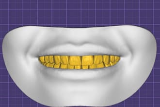 design custom dental restorations with exocad and more