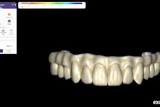 design exocad dental crown and bridge in exocad
