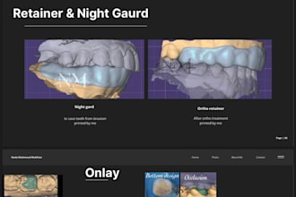 do highly percise dental prothesis and surgical guide