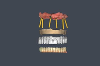 ibar and icrown design on exocad