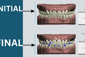 do dental clear aligner treatment planning on onyxceph and 3shape