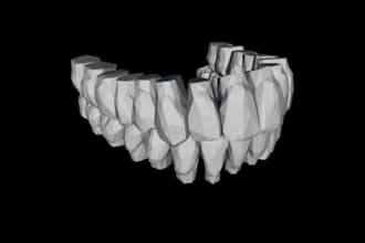 design unique crystal style teeth and crowns using exocad