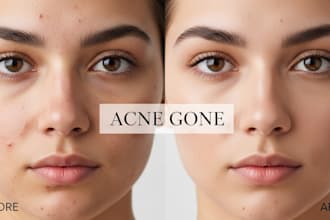 professionally retouch faces, remove pimples and acne scars