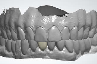 design crown, bridge, rpd, dentures and wax up using 3shape software