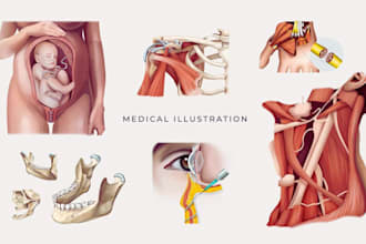 create medical illustration and graphical abstract