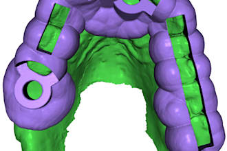 design a surgical guide for implant surgery