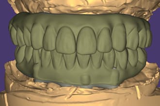 design dental cad cam exocad crowns bridges implants full arch