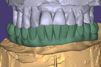 design dental cad cam exocad crowns bridges implants full arch