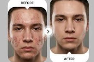 remove acne and spots from your images within 24 hours