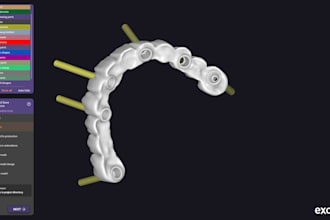 design professional exocad all on x and dental restorations