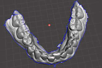 clean and optimize dental scans for 3d printing