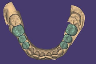 design dental crown and bridge using exocad
