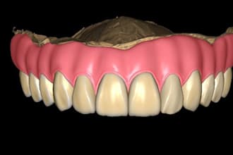deisgn dental removable dentures