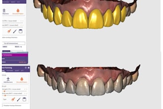 design dental mock ups