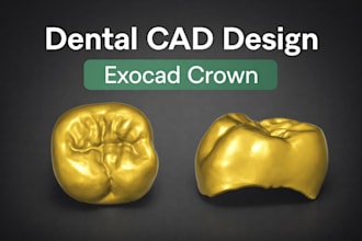 design dental crowns using exocad professionally