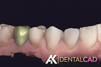 design dental cad crowns, bridges and implant restorations