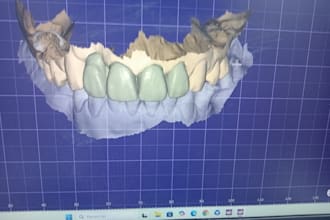 design high precision 3d dental models