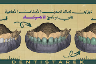 design precise exocad dental restorations as a professional dentist