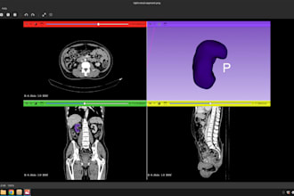 do ct and mri segmentation of a single organ, tumor, and complex blood vessel