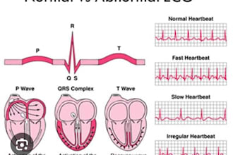 explain ecg and cardiac topics in simple language
