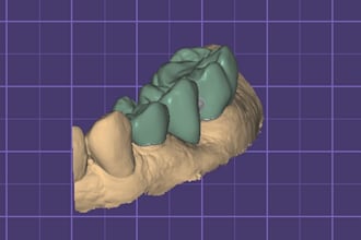 design crowns and bridges on exocad dental cad