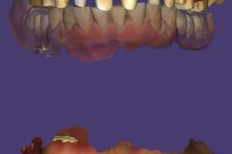 design professional dental crowns and bridges in exocad