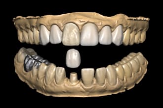 do dental prosthesis crown design using exocad, 3shape, inlab and cerec